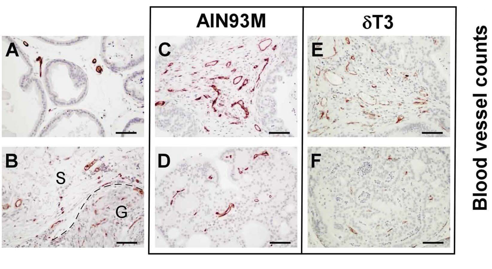 δTocotrienol is the most potent vitamin E form in inhibiting prostate